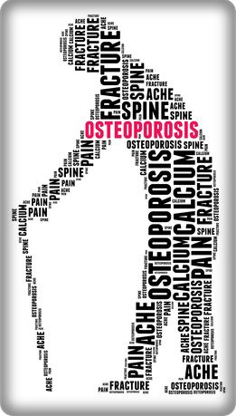 Osteoporosis Queens & Astoria, NY